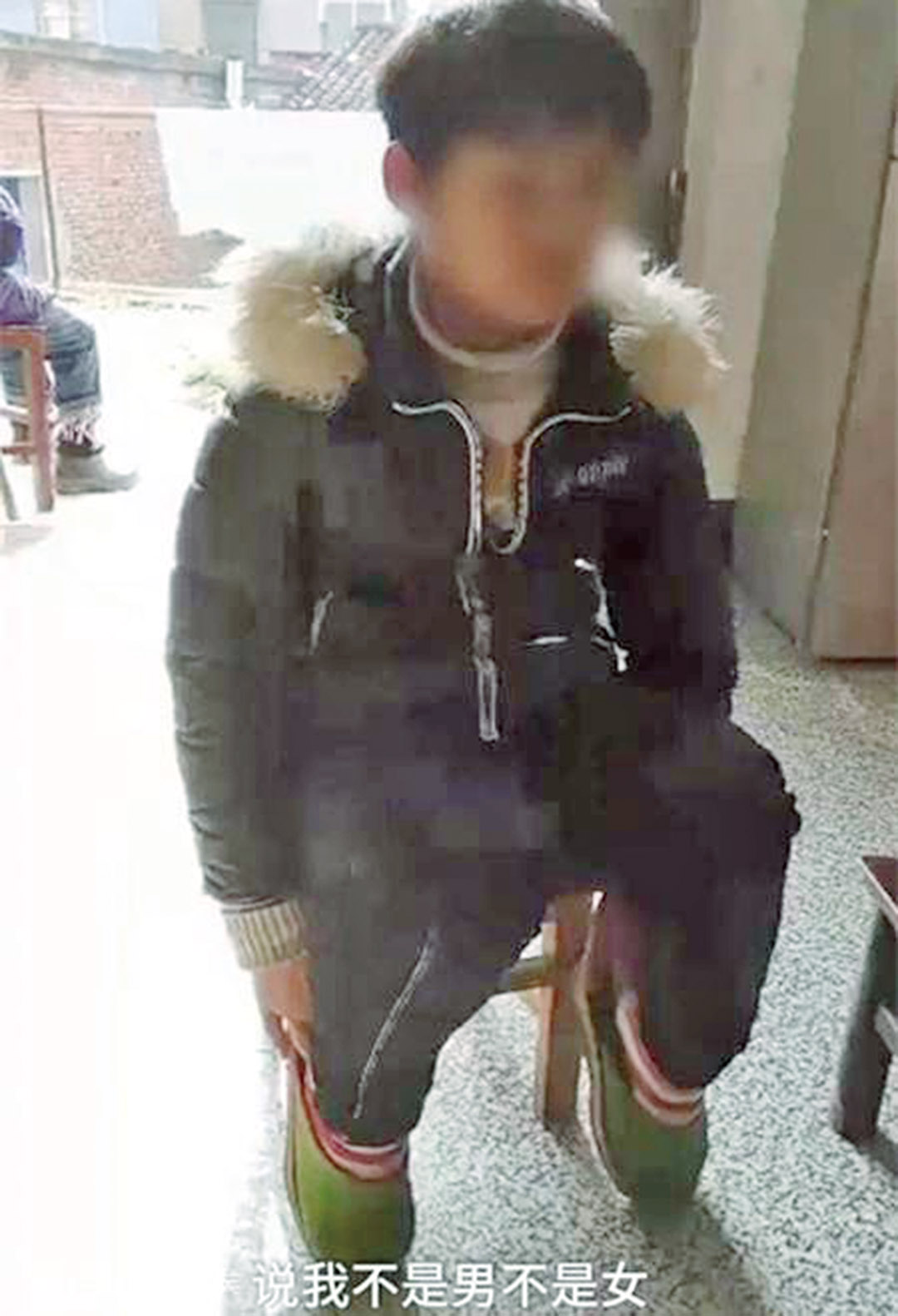 湖北八歲女童長出陰莖