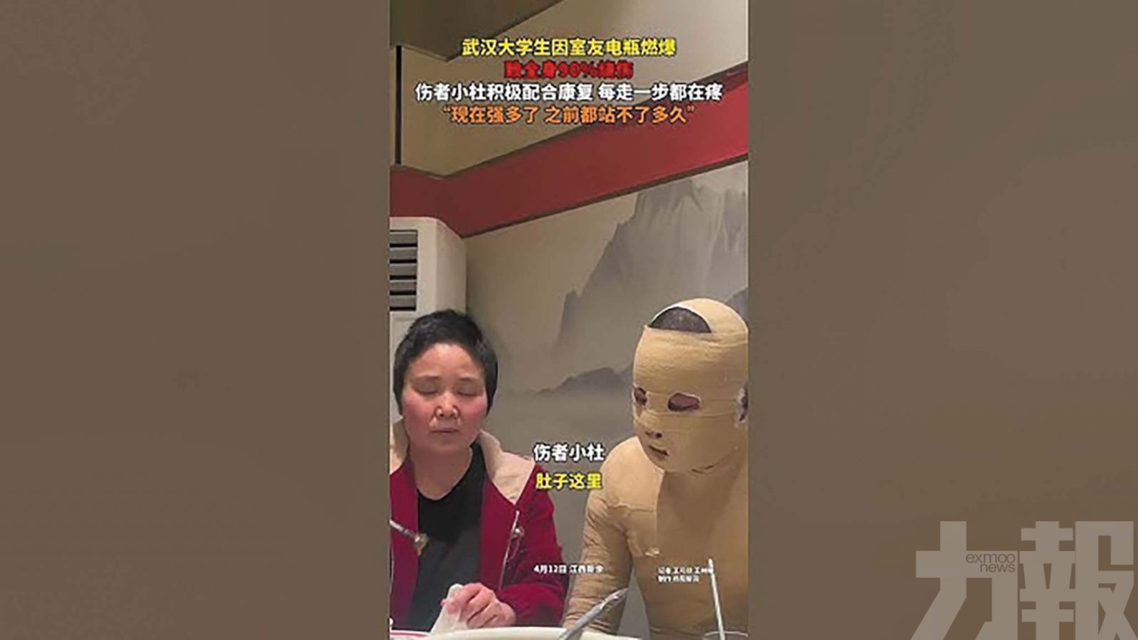 武漢大學生因室友電瓶爆炸90%燒傷