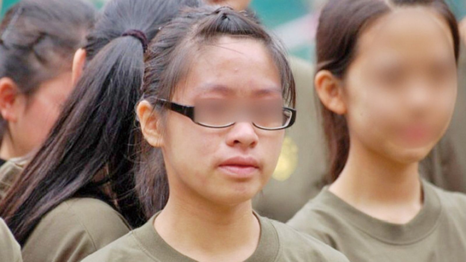 疑不滿父母遺傳濕疹