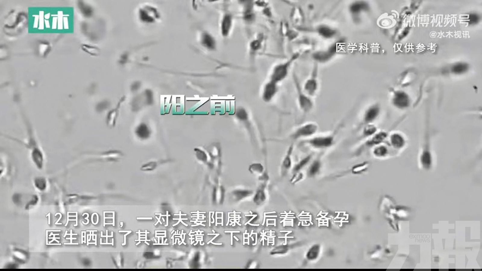 染疫後精子數量大減
