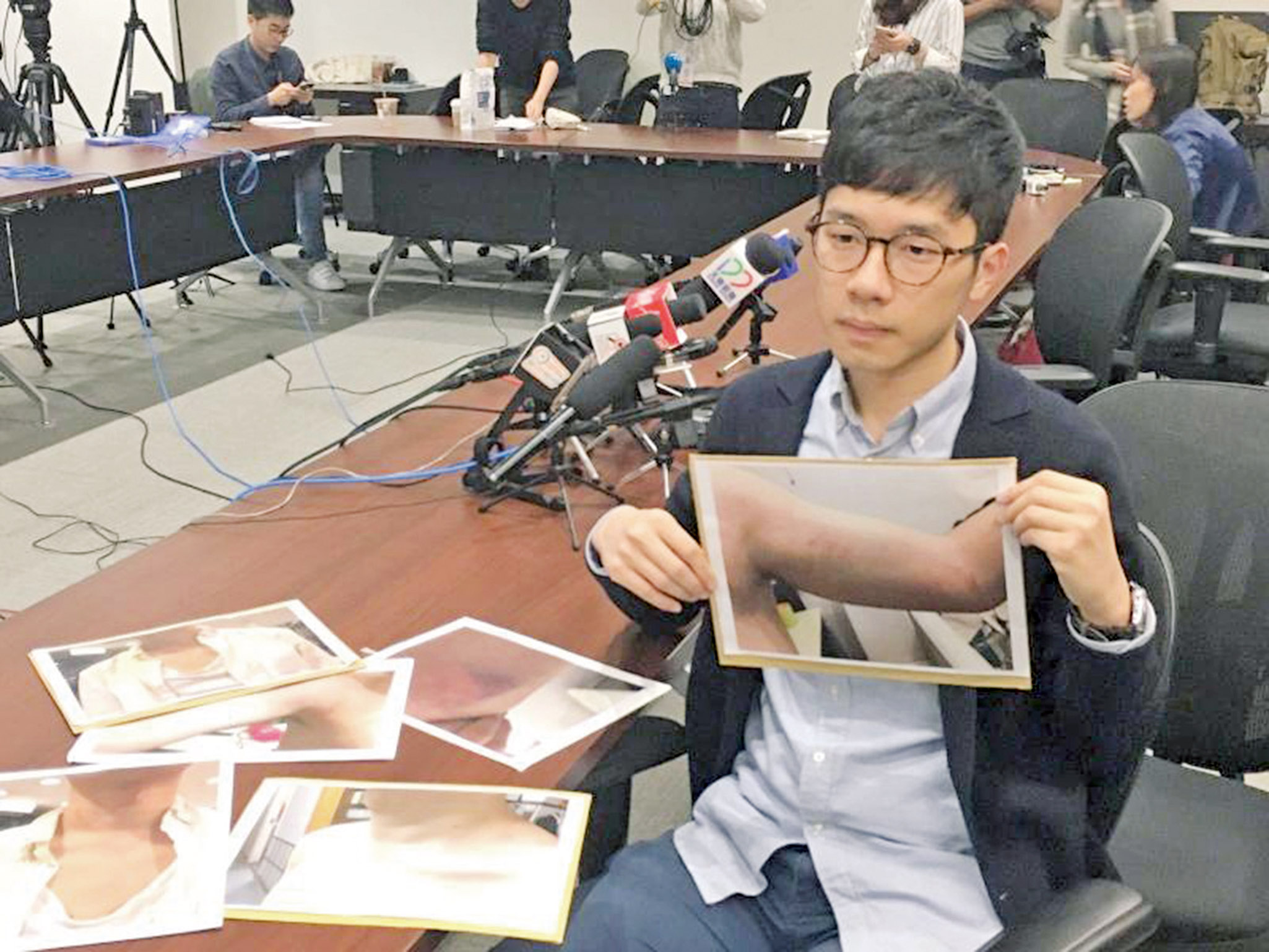 羅冠聰回應返港遇襲