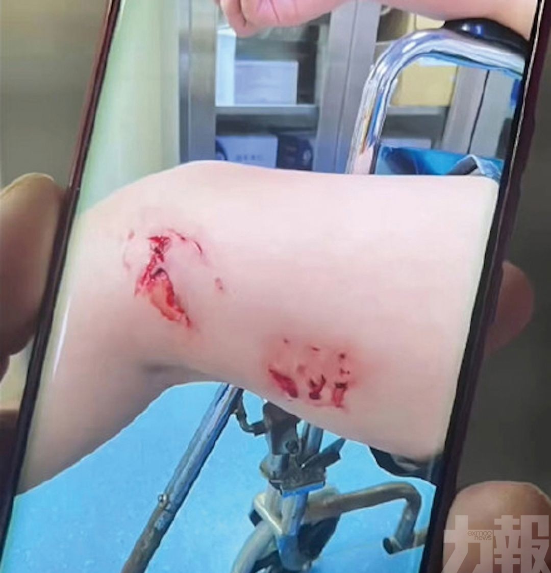 多名遊客遭「不明魚類」咬傷